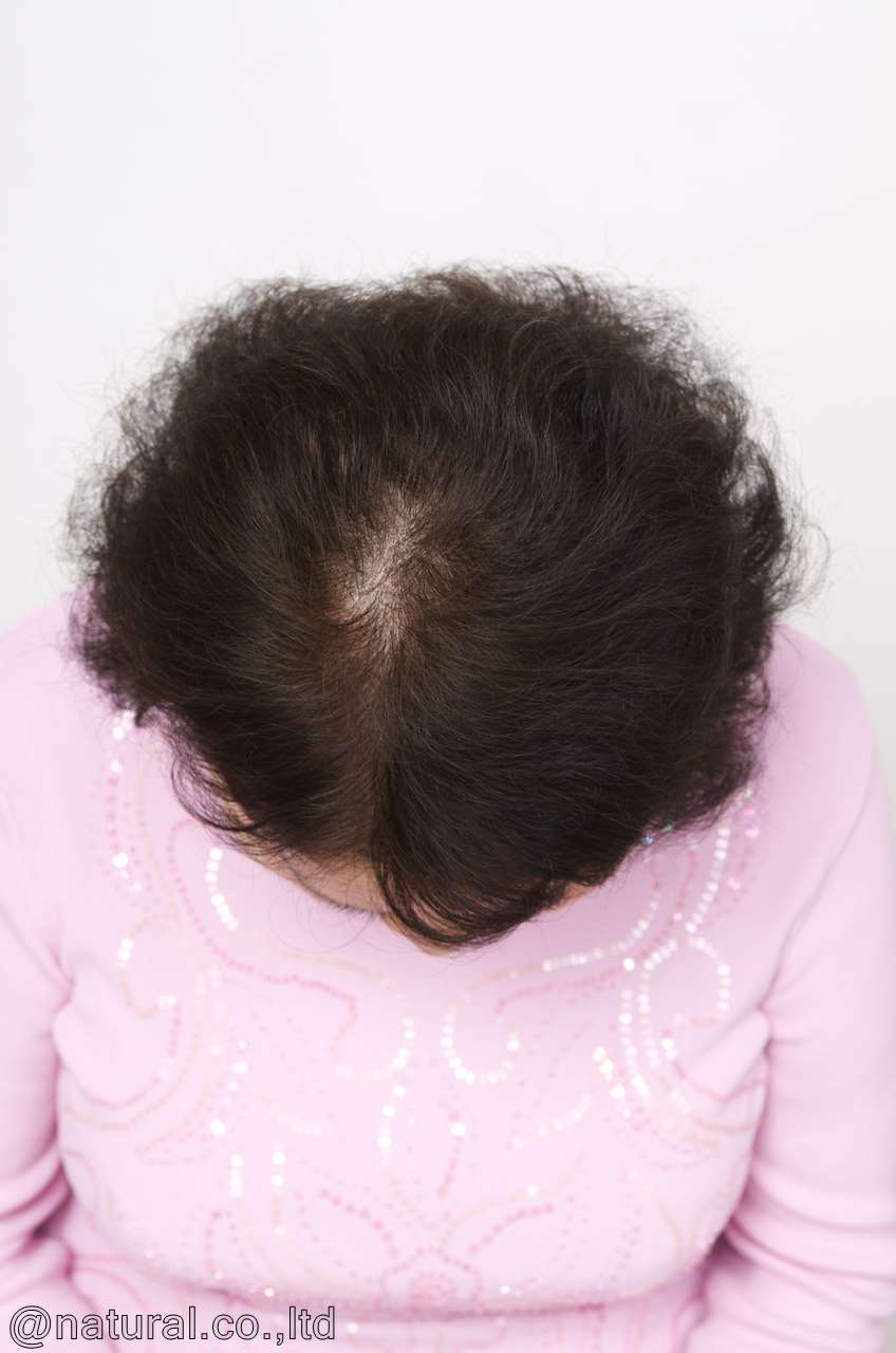 60代女性くせ毛の自毛