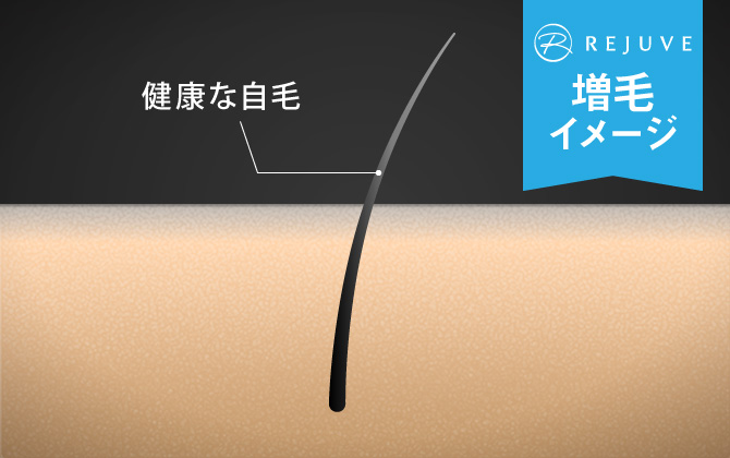 ナチュラル(株)の増毛