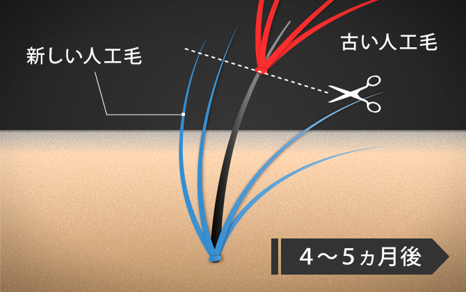 ナチュラル(株)の増毛